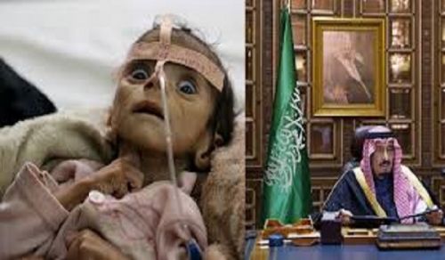 Two Years of Slaughter and Starvation of the Muslims of Yemen is not Enough to Shake the Conscience of the Current World Order!
